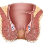 obat ambeien ambefree,obat ambeien ampuh